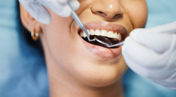 Best Emergency Dental Care for Trauma or Injury in Hollywood Park, TX