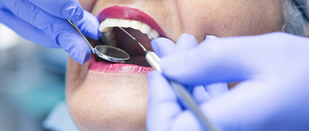 Best Emergency Dental Surgery in Hollywood Park, TX